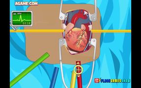 Heart Surgery Walkthrough - Games - VIDEOTIME.COM