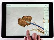 Interactive 3D Medical Animation