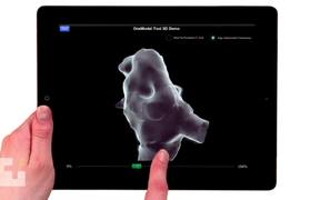 Interactive 3D Medical Animation - Tech - VIDEOTIME.COM