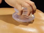 Amazing Silicone For Cupping Therapy