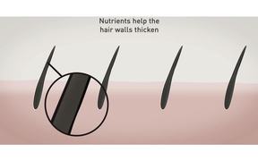 B.LAB Hair Regrowth System - How it works