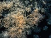 Bacteria and Fungi Time-lapse