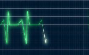 ECG Heartrate Graph Animation