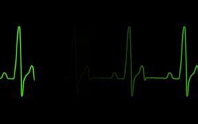 ECG Heartrate Graph - Tech - Videotime.com