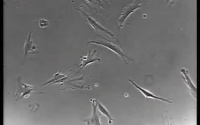 Normal vs Cancer Cells - Tech - VIDEOTIME.COM
