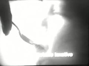 Fletcher's Castoria Commercial (1967)