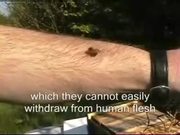 How a Bee Can Remove its Sting from Human Flesh